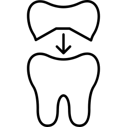 Porcelain Veneers